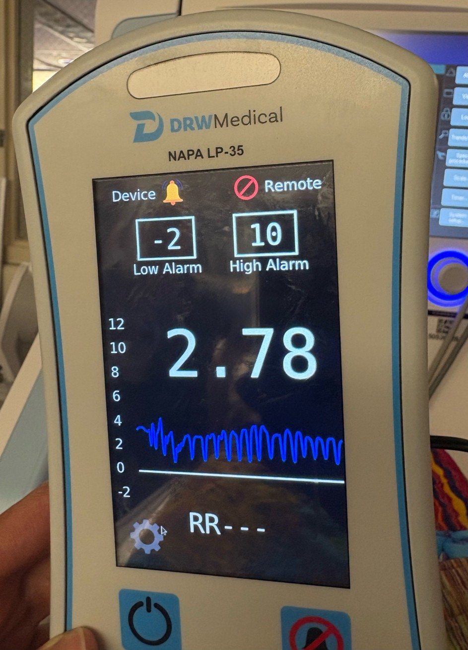 Monitor reading 2.78