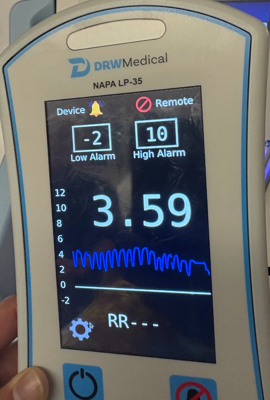Monitor reading 3.59