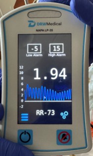 Monitor reading 1.94