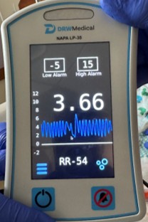 Monitor reading 3.66