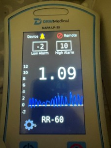 Monitor reading 1.09