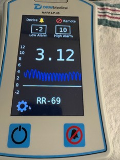 Monitor reading 3.12