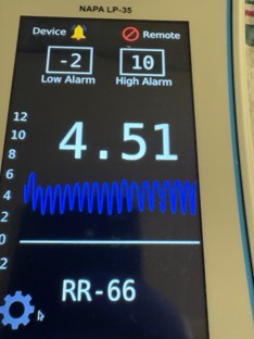 Monitor reading 4.51