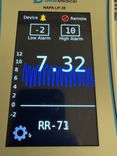 Monitor reading 7.32